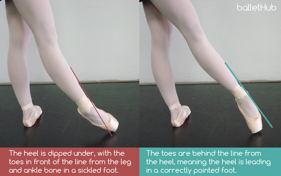 sickled foot in ballet tendu front